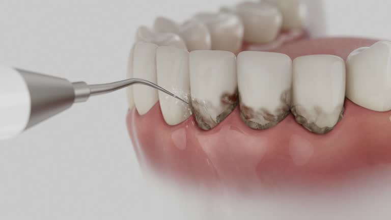 Reliable Dental contractor in Fresno, CA by Smile Center Dentistry